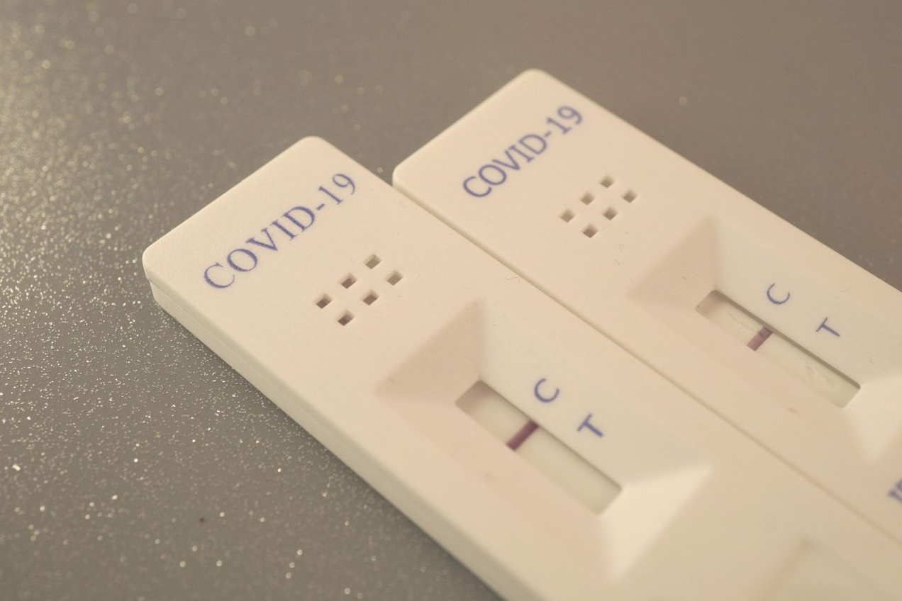 Bottroperinnen und Bottroper können sich ab sofort kostenlos im Saalbau Bottrop und in der Tanzschule Peter Frank auf das Coronavirus testen lassen.